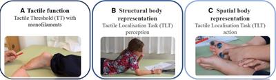 Are tactile function and body awareness of the foot related to motor outcomes in children with upper motor neuron lesions?